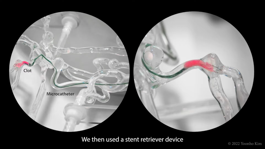 dplnew joystick sd 140422